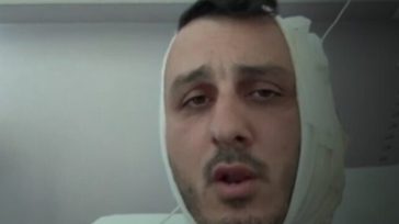 Σύρος δάγκωσε το αυτί Ισραηλινού τουρίστα στην παραλία Αλίμου