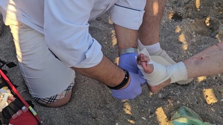 Θαλάσσια χελώνα επιτέθηκε σε λουόμενη στην Ανάβυσσο