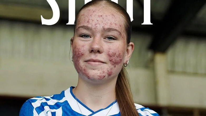 Αίσχος: Bullying σε 16χρονη παίκτρια ποδοσφαίρου για την εμφάνισή της!