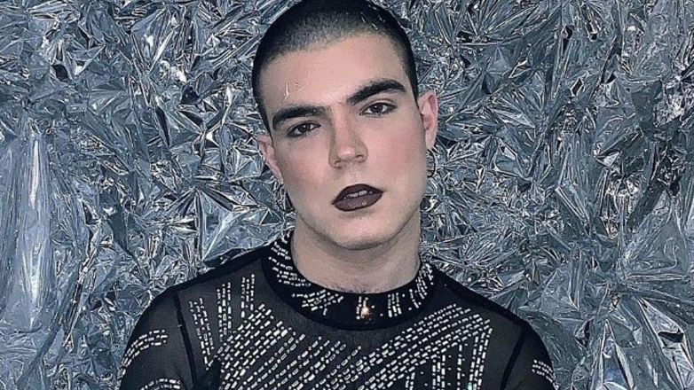 Με το νέο σεξουαλικώς μεταδιδόμενο νόσημα «TMVII» διεγνώσθη το queer μοντέλο, Jo Dennys