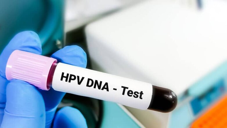 Λήψη εξέτασης HPV DNA test και στα βιοπαθολογικά εργαστήρια