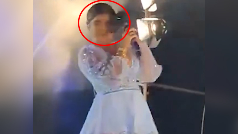 Τραγουδίστρια χτυπήθηκε στο πρόσωπο από drone κατά τη διάρκεια συναυλίας