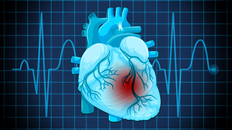 Ενδοσκοπικό Bypass χωρίς στερνοτομή Ενδοσκοπικό Bypass χωρίς στερνοτομή