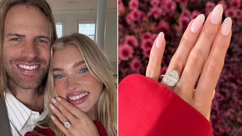 Elsa Hosk – Tom Daly: Αρραβωνιάστηκαν μετά από 10 χρόνια σχέσης – Το εντυπωσιακό δαχτυλίδι που της χάρισε