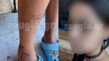 Νέες φωτογραφίες της 9χρονης που τραυματίστηκε σε τροχαίο στα Σεπόλια