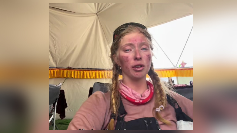 Βίντεο με 17χρονη που έμεινε 4 ημέρες στη «ζώνη θανάτου» του Έβερεστ – Επέστρεψε σε κακή κατάσταση