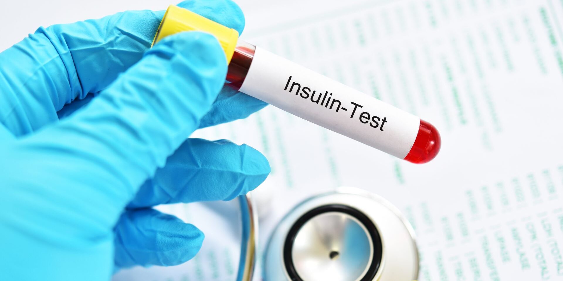 Η αντίσταση στην ινσουλίνη συνδέεται με καρδιοπάθειες και εγκεφαλικά