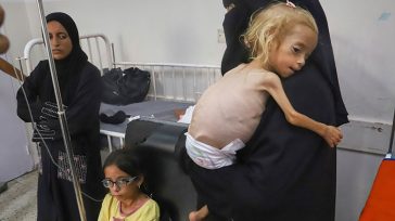 Γάζα: Οι ΜΚΟ Γιατροί του Κόσμου και Δράση κατά της Πείνας σημαίνουν συναγερμό για τον παιδικό υποσιτισμό