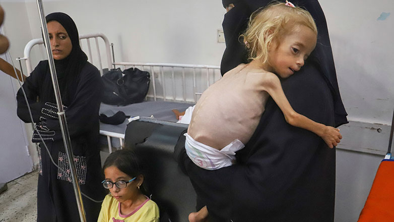 Γάζα: Οι ΜΚΟ Γιατροί του Κόσμου και Δράση κατά της Πείνας σημαίνουν συναγερμό για τον παιδικό υποσιτισμό Γάζα: Οι ΜΚΟ Γιατροί του Κόσμου και Δράση κατά της Πείνας σημαίνουν συναγερμό για τον παιδικό υποσιτισμό