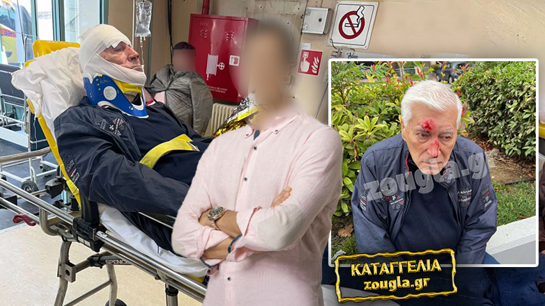 Γνωστός γιατρός της Θεσσαλονίκης ξυλοκόπησε άγρια ηλικιωμένο επιχειρηματία, έπειτα από ασήμαντο τροχαίο