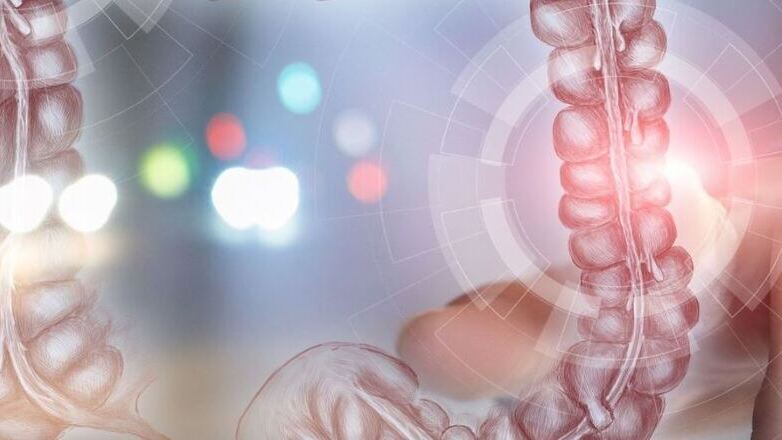 Εκκολπωμάτωση παχέος εντέρου: Παράγοντες κινδύνου και θεραπευτικές επιλογές