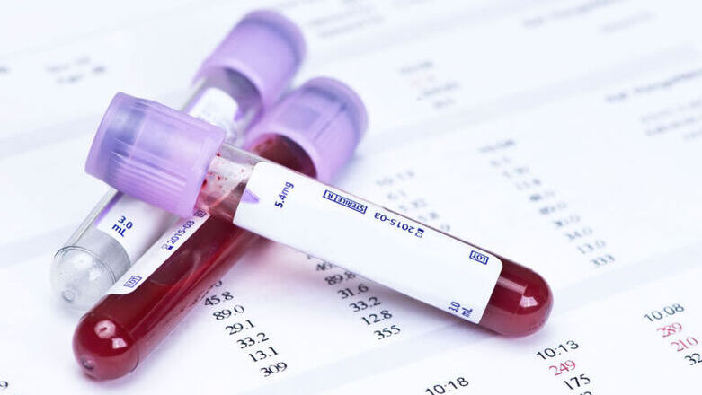 Εξελίξεις στις αιματολογικές κακοήθειες