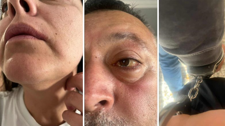 Έβαλαν χειροπέδες και κακοποίησαν ζευγάρι Τούρκων τουριστών γιατί μετέφεραν… τσιγάρα! Έβαλαν χειροπέδες και κακοποίησαν ζευγάρι Τούρκων τουριστών γιατί μετέφεραν… τσιγάρα!