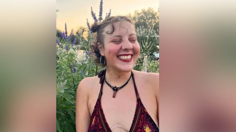 Πέθανε η 26χρονη Αναστασία Τασούλα, μετά από πολύμηνη μάχη με την κυστική ίνωση Πέθανε η 26χρονη Αναστασία Τασούλα, μετά από πολύμηνη μάχη με την κυστική ίνωση