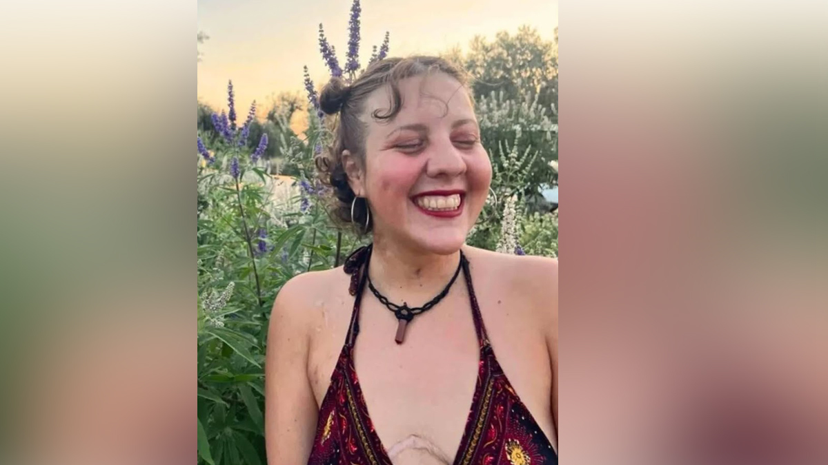 Πέθανε η 26χρονη Αναστασία Τασούλα, μετά από πολύμηνη μάχη με την κυστική ίνωση