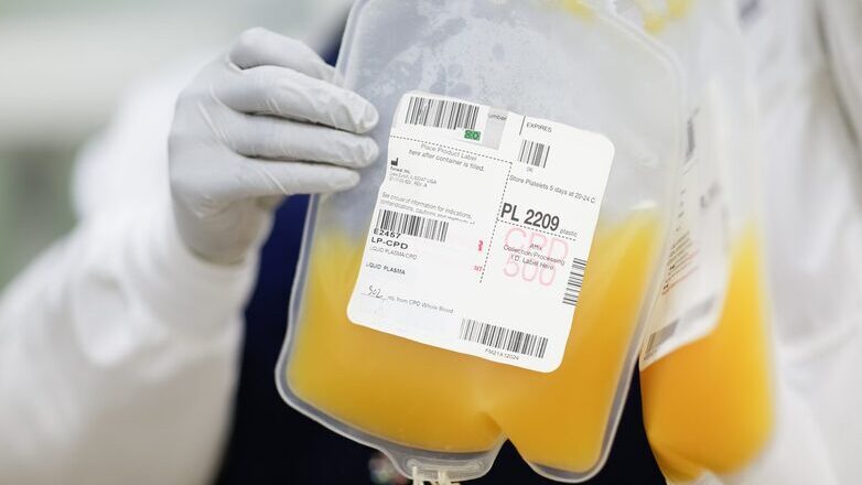 ΣΦΕΕ: Γιατί είναι αναγκαίο ένα νέο πλαίσιο συλλογής πλάσματος στην Ελλάδα