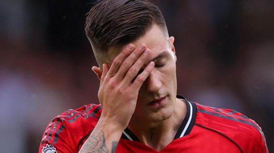 Μάντσεστερ Γιουνάιτεντ: Nοκ-άουτ για έναν μήνα ο Σέσκο