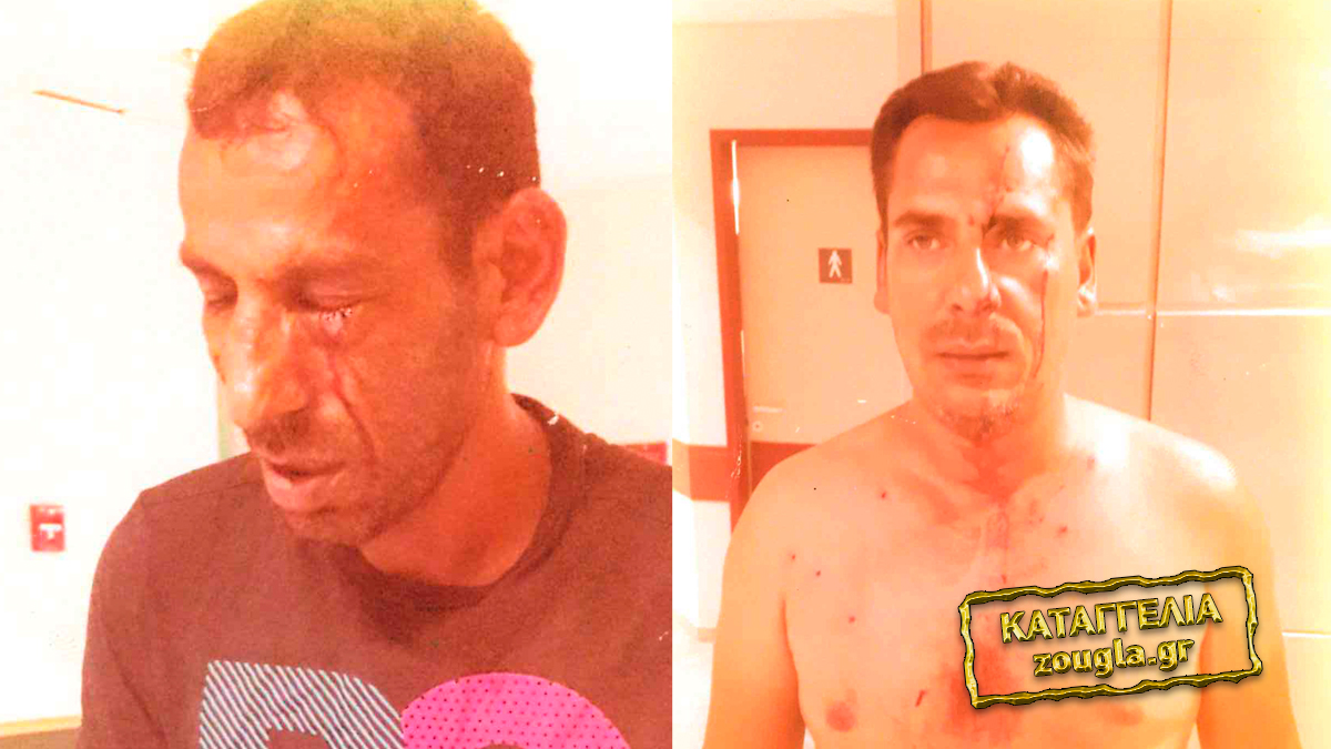 Πρωτοδικείο Κω: Εκδικάζεται τη Δευτέρα η υπόθεση του τραυματισμού 13 Ρομά από πυροβολισμούς το 2018