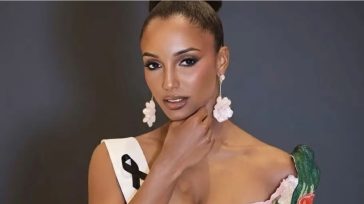 Αγωνία για τη Μις Τζαμάικα: Νοσηλεύεται σε κρίσιμη κατάσταση με ενδοκρανιακή αιμορραγία