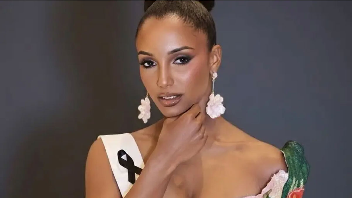 Αγωνία για τη Μις Τζαμάικα: Νοσηλεύεται σε κρίσιμη κατάσταση με ενδοκρανιακή αιμορραγία