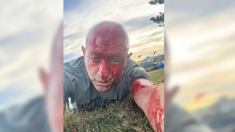 Επιζών της Χαμάς έζησε και το αιματοκύλισμα στο Σίδνεϊ Επιζών της Χαμάς έζησε και το αιματοκύλισμα στο Σίδνεϊ