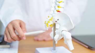 Kύστη κόκκυγoς: Αίτια, συμπτώματα και θεραπεία