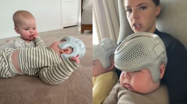 Σοκ στις ΗΠΑ: Influencer φορά στα μωρά της κράνη 23 ώρες την ημέρα