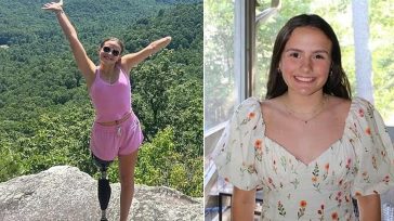 «Έχασα το χέρι μου και το πόδι μου από επίθεση καρχαρία»