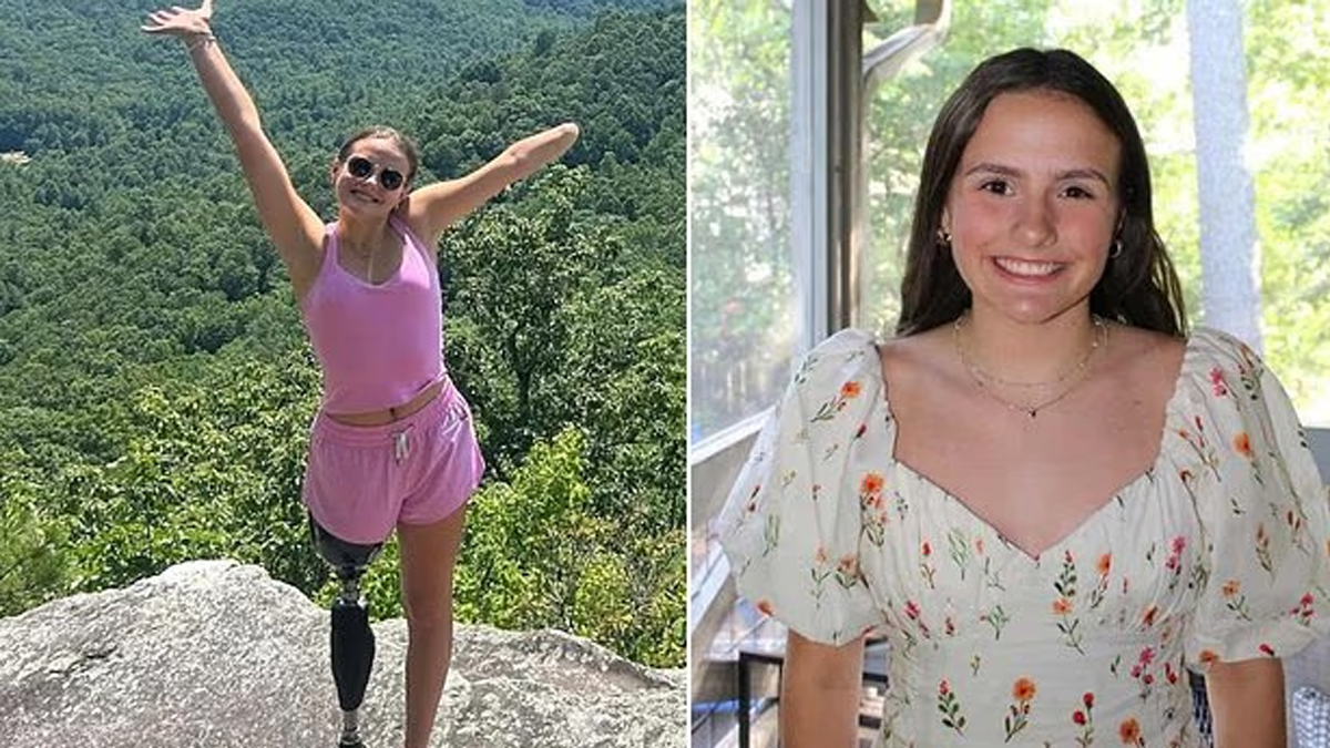 «Έχασα το χέρι μου και το πόδι μου από επίθεση καρχαρία»