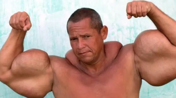 Πέθανε στα 55 του ο «Βραζιλιάνος Ποπάι»