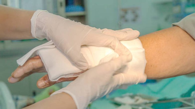 Νέα δερματικά μοσχεύματα για σοβαρά εγκαύματα για τους επιζώντες του Κραν Μοντανά