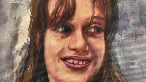 «48 ώρες χορεύοντας με έναν άγγελο»: Η ιστορία της Κατερίνας-Μαρίας που γεννήθηκε με το σύνδρομο Angelman