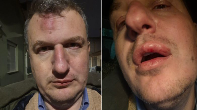 Βόλος : Άγρια επίθεση στον εκδότη της εφημερίδας «Μαγνησία» έξω από το σπίτι του Βόλος : Άγρια επίθεση στον εκδότη της εφημερίδας «Μαγνησία» έξω από το σπίτι του