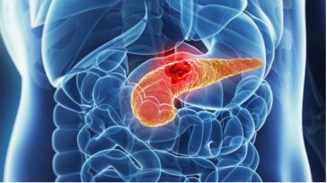 Μείγμα τριών φαρμάκων μειώνει τον καρκίνο του παγκρέατος σε ποντίκια