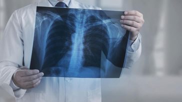 Νωτιαία μυϊκή ατροφία: Η Biogen έλαβε έγκριση από την ΕΕ για το σχήμα υψηλής δόσης του nusinersen για τη 