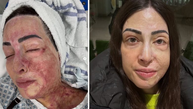 Ιωάννα Παλιοσπύρου: Μοιράζεται φωτογραφίες και βίντεο από την αποκατάστασή της – «Ποτέ μην τα παρατάτε»