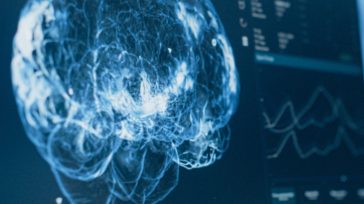 Nevron: Η νευροχειρουργική ομάδα που φέρνει την καινοτομία στο χειρουργείο