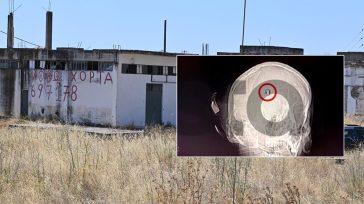 Άργος: Η μαγνητική τομογραφία «δείχνει» ευθεία βολή