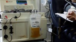 Όλη η έκθεση της Διεύθυνσης Εγκληματολογικών Ερευνών για το μηχάνημα πλασμαφαίρεσης