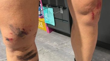 Κρυονέρι: Άνδρας καταγγέλλει ότι τον δάγκωσε λύκος – «Πάλευα για 8 λεπτά»