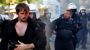 Αλβανία: Σφοδρές συγκρούσεις φοιτητών με την αστυνομία στα Τίρανα