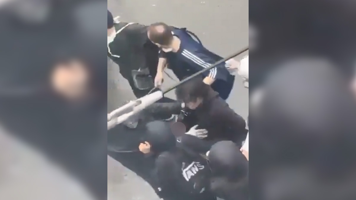 Γαλλία: Ακρωτηριάστηκε 20χρονος διαδηλωτής στο Σεντ-Ετιέν