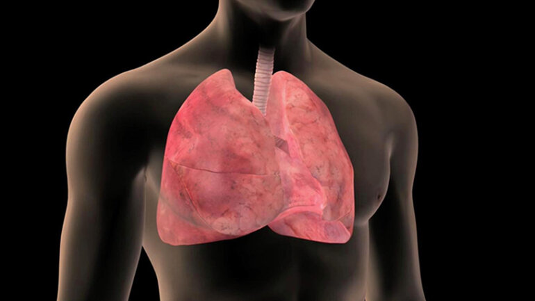 Φωτοδυναμική θεραπεία: Η επαναστατική θεραπεία στον καρκίνο του πνεύμονα