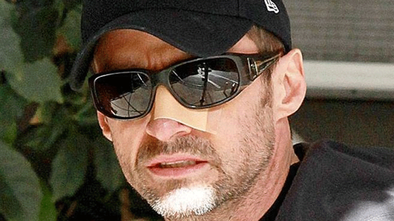 Η μάχη του Hugh Jackman με τον καρκίνο και η καμπάνια αφύπνισης του κόσμου!