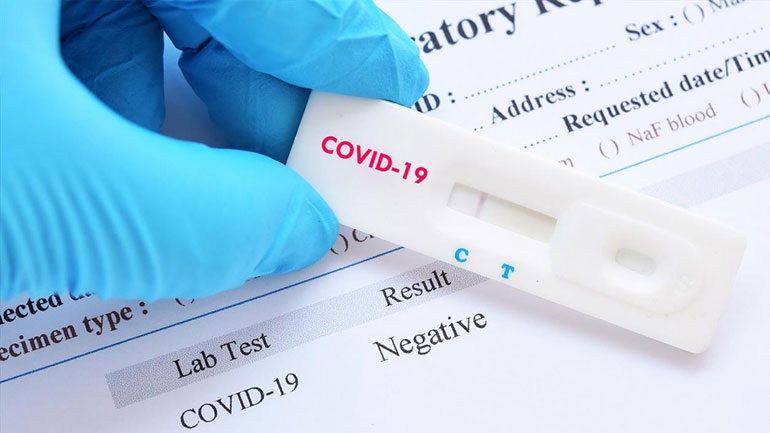 Δύο νέα τεστ κατά του Covid: Ένα που ανιχνεύει τις μεταλλάξεις και ένα που προβλέπει τη σοβαρότητα της λοίμωξης