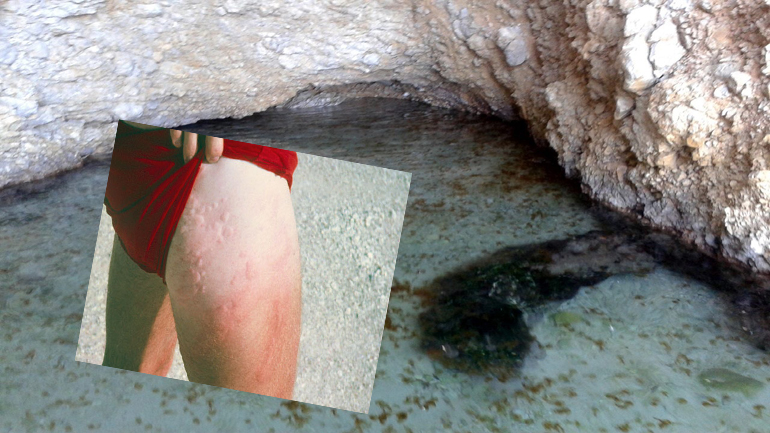 O εφιάλτης με τις τσούχτρες επιστρέφει