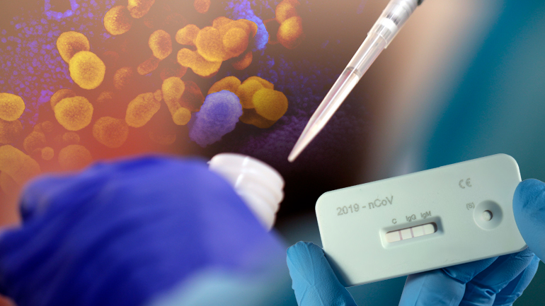 Επιβεβαιώθηκαν 27 νέα κρούσματα κορωνοϊού