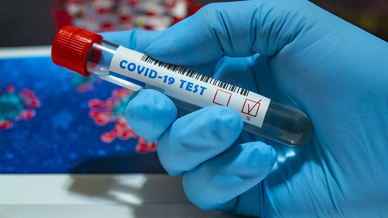 Nέο τεστ από Έλληνες ερευνητές για τον Covid-19