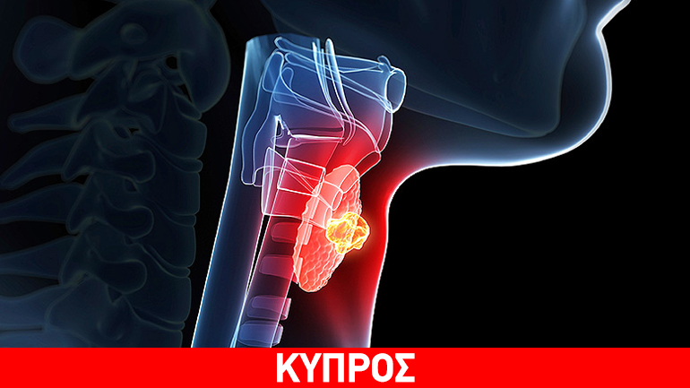 Κύπρος: Στην 4η  θέση της Ευρώπης σε καρκίνο του θυρεοειδούς