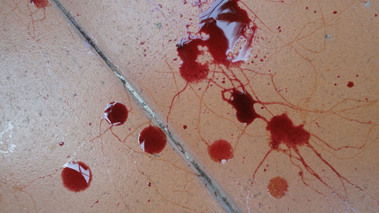 Αγρίνιο: Αποπειράθηκε να αυτοκτονήσει και συνελήφθη